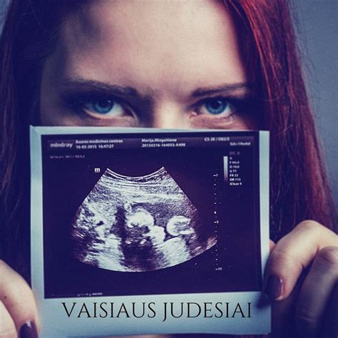 vaisiaus judesiai ultragarsu