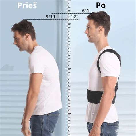 Kifozinės laikysenos iliustracija