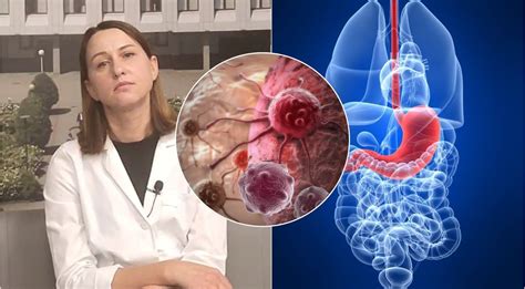 preeklampsijos simptomai ir rizika