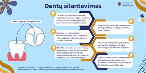 dantų silantavimas