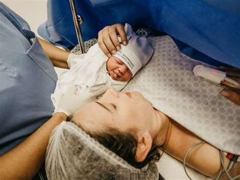 Žindymas po cezario pjūvio