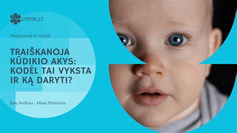 kūdikio akys su traiškanomis