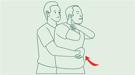 Žmogus atlieka Heimlicho manevrą