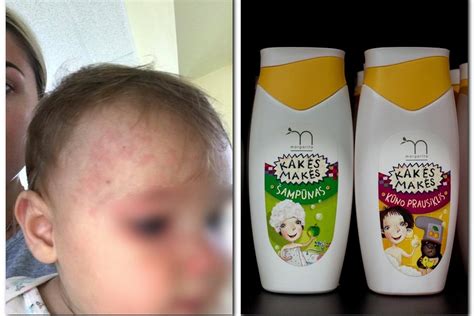 vaikiško šampūno naudojimo svarba