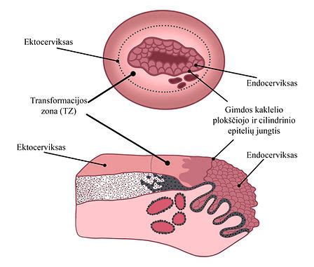 Blastocistos implantacija į gimdos sienelę