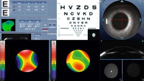 Kūdikio akių patikrinimas