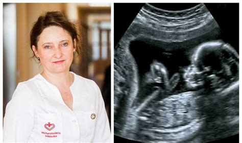 moters rankos laiko vaisiaus vaisiaus ultragarso nuotrauką