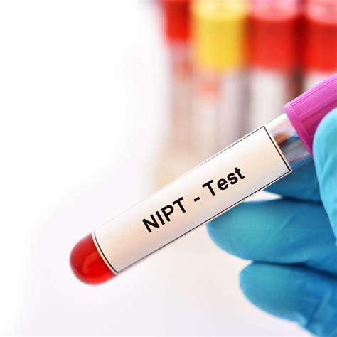NIPT tyrimo principas