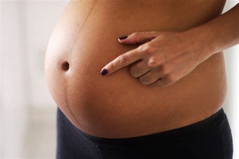 stryju atsiradimas ant pilvo