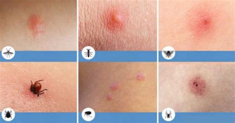 įvairių vabzdžių tipai, kuriuos lesa paukščiai