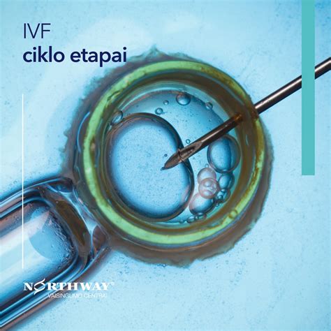 IVF ciklo schema