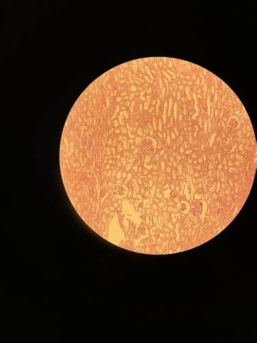 Spermatozoidų mikroskopinis vaizdas