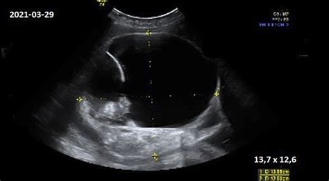 Vaisiaus dydis 28 nėštumo savaitę