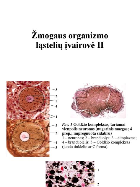 Žmogaus ląstelės pažeidžiamos laisvųjų radikalų
