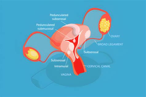 Gimdos ir placentos anatomija