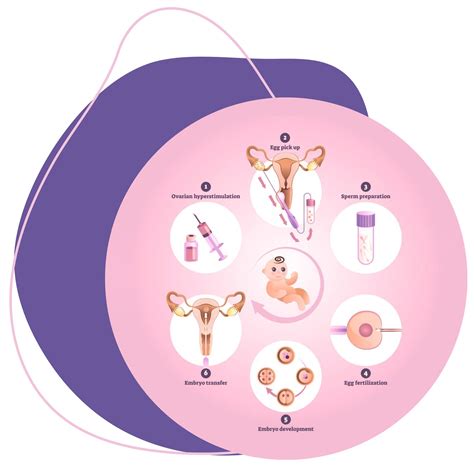 diagrama, parodanti IVF proceso etapus