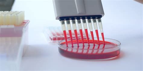 Laboratorinis kraujo tyrimas