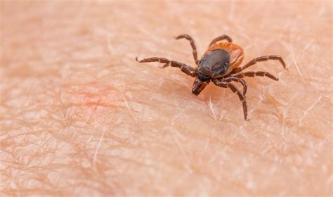 erkė ant žmogaus odos