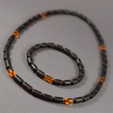 Rachitinės deformacijos: šonkaulių karoliai ir apyrankės