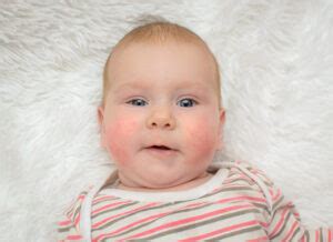 Kūdikio veidas, atitinkantis nuotraukos reikalavimus