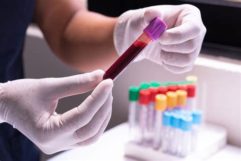 laboratoriniai kraujo tyrimai nėštumo metu