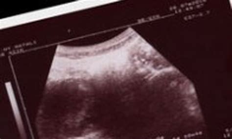 Kūdikis atlieka pirmuosius judesius