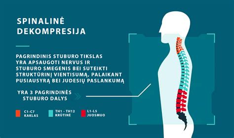 Spinalinės nejautros schema