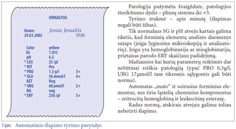 Šlapimo tyrimo interpretacija