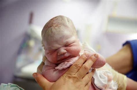 Naujagimio galvos laikymas