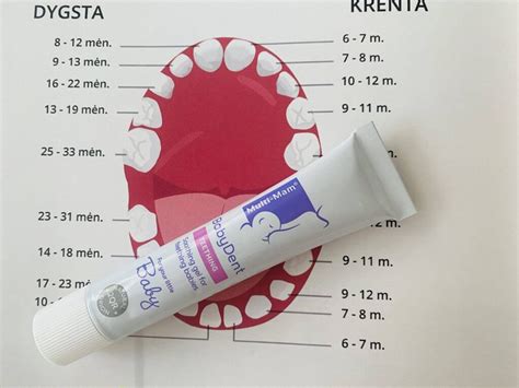 kūdikio dantenos, kai dygsta dantukai