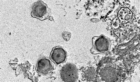 Mikroskopinis vaizdas: virusai