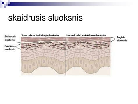 Vaisiaus odos apsauginis sluoksnis