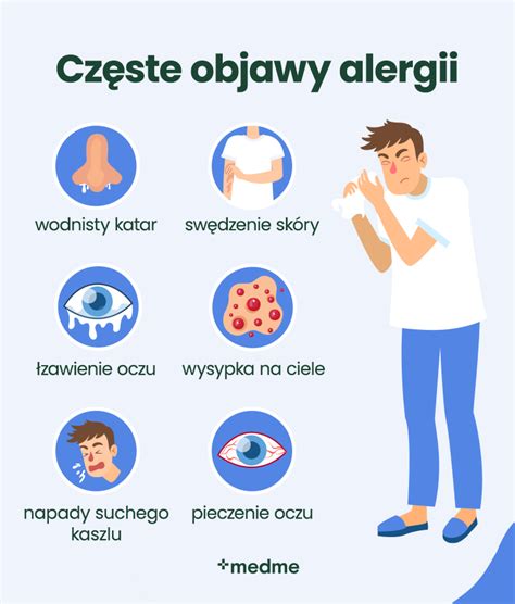 Alergijos žuviai simptomai