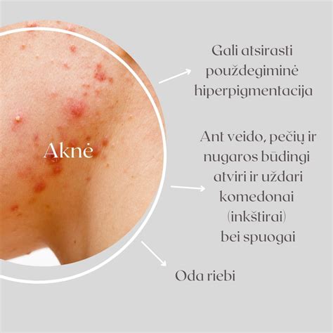 naujagimio odos problemos