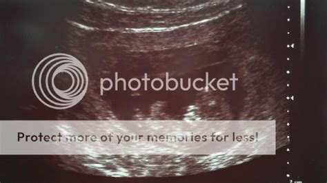 vaisiaus vystymasis 3 trimestras