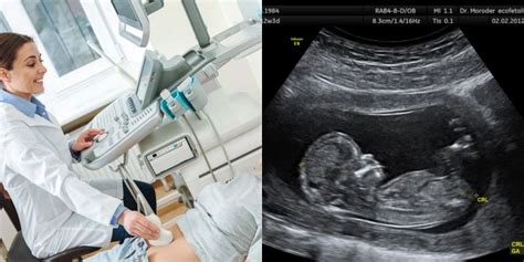 vaisiaus ultragarsas