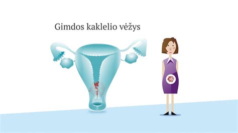 vaisiaus vystymosi modeliai