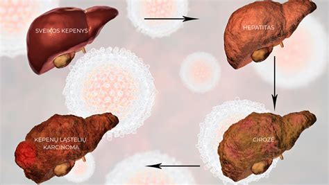 schematinis kepenų paveikslėlis